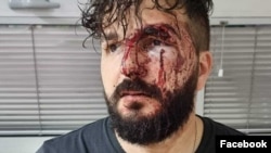 Osnivač portala Times.ba Mirza Dervišević nakon napada u Brčkom.