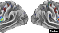 Three colored spots on each half of the brain show special locations in the movement areas of the brain that connect to areas involved in thinking, planning and control of basic bodily functions such as heart rate. (Evan Gordon/Washington University/Handout via REUTERS)