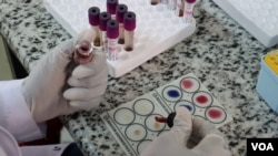 Utafiti wa ugonjwa wa TB ukifanyika katika maabara za mtafiti mkuu katika taasisi ya matibabu na utafiti, Kenya KEMRI. Picha na Amina Chombo