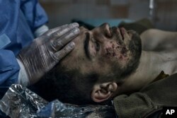 Vojni lekari pružaju prvu pomoć vojniku ranjenom u bici u Bahmutu, Donjecka oblast, Ukrajina, nedelja, 9. april 2023. (Foto: AP/Libkos)