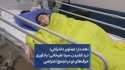 |هشدار: تصاویر دلخراش| درد کشیدن سینا علیخانی؛ یادآوری حرف‌های او در تجمع اعتراضی