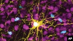 This microscope image provided by Pasca Lab/Stanford Medicine shows a human astrocyte cell, center in yellow, and human glial cells (scattered in blue) inside the brain of a rat.