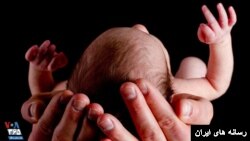 نوزاد (عکس تزئینی)