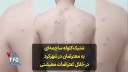 شلیک گلوله ساچمه‌ای به معترضان در شهرکرد در خلال اعتراضات معیشتی 