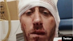 Vladimir Kovačević nakon napada ispred zgrade u kojoj živi