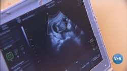 Abort huquqimi yoki tug’ilmagan bolaning yashash huquqi? 