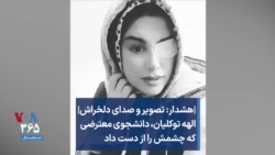 هشدار: تصویر و صدای دلخراش| الهه توکلیان، دانشجوی معترضی که چشمش را از دست داد