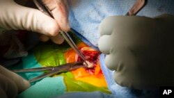 This photo provided by Duke Health shows a thymus transplant to a pediatric heart patient on Aug. 16, 2021 at Duke University Hospital in Durham, N.C. Duke University doctors say the baby is thriving after a first-of-its-kind heart transplant -- one that came with a bonus technique to try to help prevent rejection of the new organ. The thymus plays a critical role in building the immune system. (Shawn Rocco/Duke Health via AP)