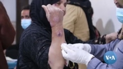 Leishmania Cases Rampant in Northeast Syria Town 