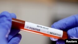 Epruveta sa testom na koronavirus