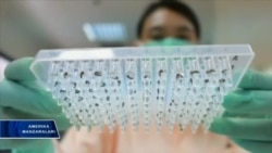 Zika yangi virus emas lekin vaksina yo'q