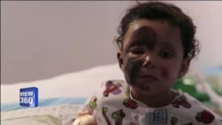 سخت موسم میں پناہ گزینوں کی مشکلات میں اضافہ