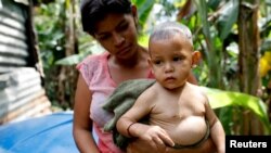 Las precarias condiciones de vida en Venezuela hacen que sea más fácil la propagación de enfermedades como el dengue, entre otras.