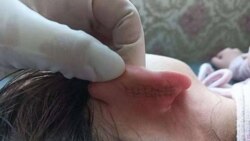 內蒙漢族女教師毆打蒙古女童致嚴重傷害 引起蒙古民眾強烈不滿