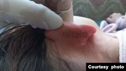 漢語教師梁玉霞扯裂蒙古九歲女學生的耳根，導致嚴重傷害。(南蒙古人權資訊中心提供)