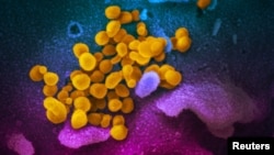 រូបឯកសារ៖ រូបភាពបង្ហាញវីរុសកូរ៉ូណា (ពណ៌លឿង) ដែលបង្កជាជំងឺរលាកផ្លូវដង្ហើមធ្ងន់ធ្ងរ កូវីដ១៩។ (Niaid-RML/Handout via Reuters)