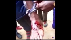 L'armée tire pour disperser des réfugiés congolais qui manifestaient au Rwanda (vidéo)