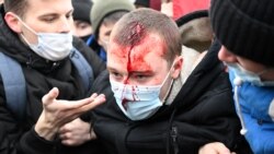 အတိုက်အခံ ဆန္ဒပြသမားတွေ ဖမ်းဆီးတဲ့ ရုရှားကို အရေးယူဒဏ်ခတ်ဖို့ ပြင်သစ် တိုက်တွန်း