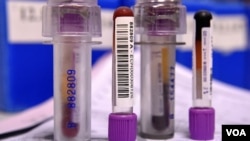 A და B დოპინგ სინჯები