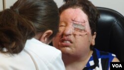 آمنه بهرامی نوا، روز بعد از پیوند پلک و پیوند قرنیه و تعویض پانسمان- تکه سفید رنگ روی پلک، پوست پیوند شده بازو است.