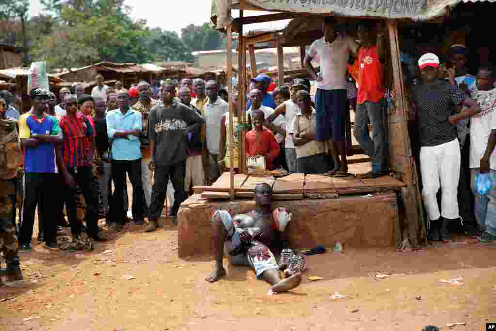 A suspected member of a militia lays wounded by machete blows in the Kokoro neighborhood of Bangui, Central African Republic, Dec. 9, 2013.