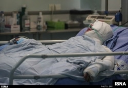 سهیلا جورکش یکی از قربانیان اسیدپاشی اصفهان