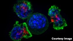 კიბოს უჯრედი, რომელიც T უჯრედების ალყაშია 