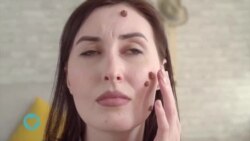 Tunaangazia vinyama vidogo au visunzua vinavyojitokeza kwenye ngozi ya binadamu.