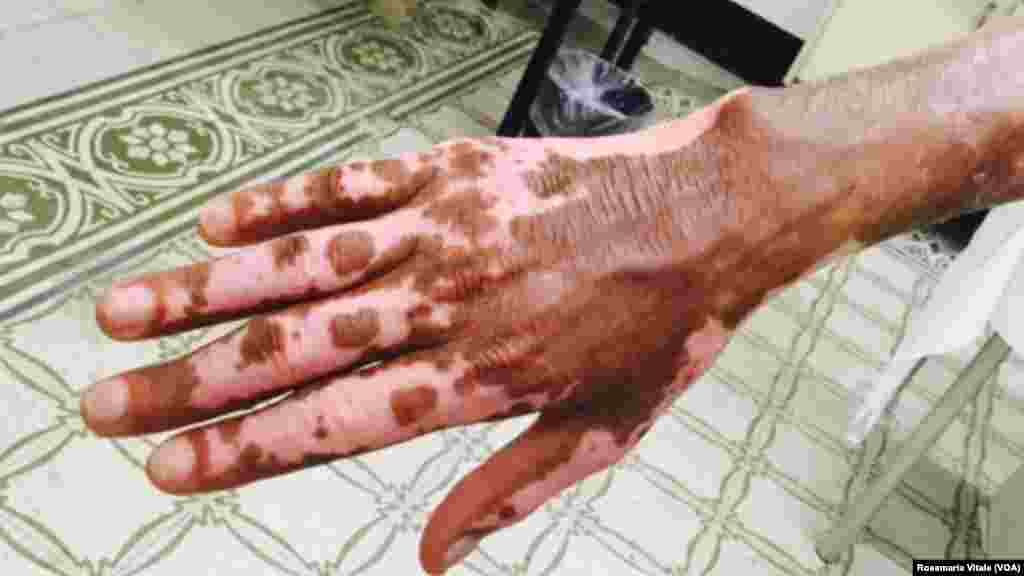 አብ ጉዕዞ ሊብያ-አውሮጳ ብነጋዶ ደቂ-ሰባት ኣእዳው ዝተቃጸለ ስእሊ እቲ ግዳይ አብ ኢጣልያ -ሚላን ስደተኛታት ካብ ዝሕክም ኢጣልያዊ ዝተረኽበ'ዩ