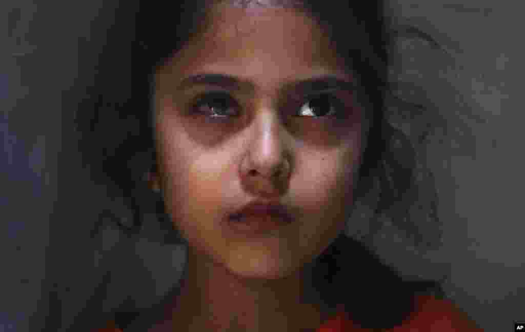 The right eye of six-year-old Muneefa Nazir, a Kashmiri girl, was reportedly shot by Indian paramilitary soldiers. She stands outside her home in Srinagar on September 17, 2019. (AP Photo/Mukhtar Khan)