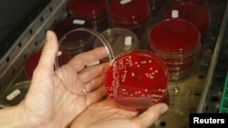 FILE - An employee displays MRSA bacteria strain — a drug-resistant "superbug" — inside a petri dish containing agar jelly for bacterial culture in a microbiological laboratory in Berlin.