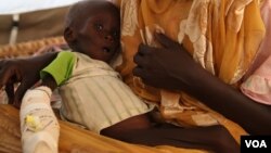 A malnourished baby in a hospital run by Doctors Without borders in Jamam, Upper Nile state, June 20, 2012 (Hannah McNeish/VOA).