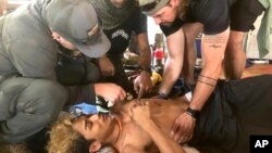 បុរស​ម្នាក់​ត្រូវរបួស​ដោយការ​ប្រយុទ្ធ​នៅ​រដ្ឋ Karen មីយ៉ាន់ម៉ាកាលពីថ្ងៃទី​៣១ មីនា ឆ្នាំ២០២៤។