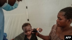 ሰሜን ጎማ ውስጥ በሚገኝ የኤምፖክስ ህክምና ማዕከል ውስጥ አንዲት ህፃን በእናቷ እየታገዘች ህክምና ሲደረግላት - ነሐሴ 17, 2024