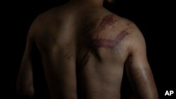 تصویر یک ژونالستان افغان که توسط طالبان لت و کوب شده است (تصویر از آرشیف صدای امریکا)