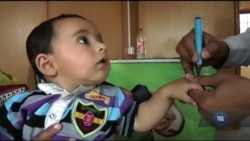 Як людство перемогло поліомієліт і чому він лишається загрозою. Відео