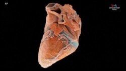 Սրտի եռաչափ պատկերման նոր մեթոդը լայն հնարավորություններ է բացում սրտանոթային բժշկության համար