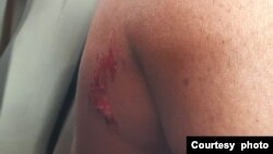 Suspected Zanu PF activists attack CCC members in Matobo