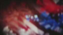 اتصال تلویزیوني خپرونه 