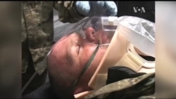 Через бюрократію до зони АТО лише зараз відправили госпіталь зі США. Відео