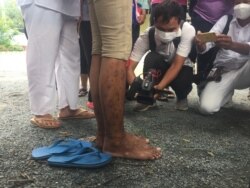 កាក់ សុវណ្ណច្ឆ័យ មាន​បញ្ហា​រម៉ាស់ជើង ក្នុងពេល​រស់នៅ​ក្នុង​ពន្ធនាគារ។ រូបថត ថត​នៅ​ថ្ងៃទី១០ ខែវិច្ឆិកា ឆ្នាំ២០២១។ (មាស មល្លិកា/វីអូអេ)