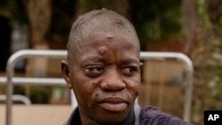 Picha ya maktaba ya mtu aliyeambukizwa mpox. Zimbabwe Jumapili imetangaza kesi za kwanza.