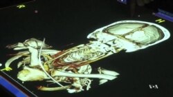 เทคโนโลยีสมัยใหม่ช่วยให้แพทย์สามารถวินิจฉัยภายในร่างกายของคนไข้ได้อย่างน่าทึ่ง