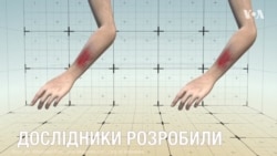 «Розумний бинт» загоює рани втричі швидше, ніж звичайна медична перев’язка. Відео