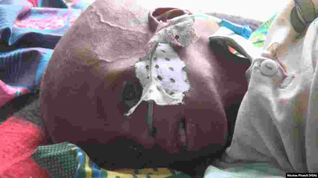 ደርቅን ዓጸቦን ኣብ ናይጀርያ - ዲፋ