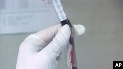 Hospital Pediátrico de Luanda: Uma luta constante contra o SIDA