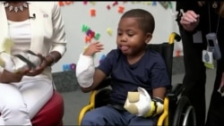 Лікарі повернули 8-річній дитині руки. Відео