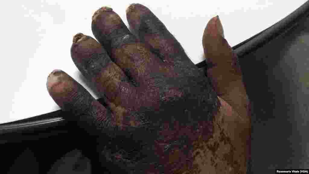 አብ ጉዕዞ ሊብያ-አውሮጳ ብነጋዶ ደቂ-ሰባት ኣእዳው ዝተቃጸለ ስእሊ እቲ ግዳይ አብ ኢጣልያ -ሚላን ስደተኛታት ካብ ዝሕክም ኢጣልያዊ ዝተረኽበ'ዩ