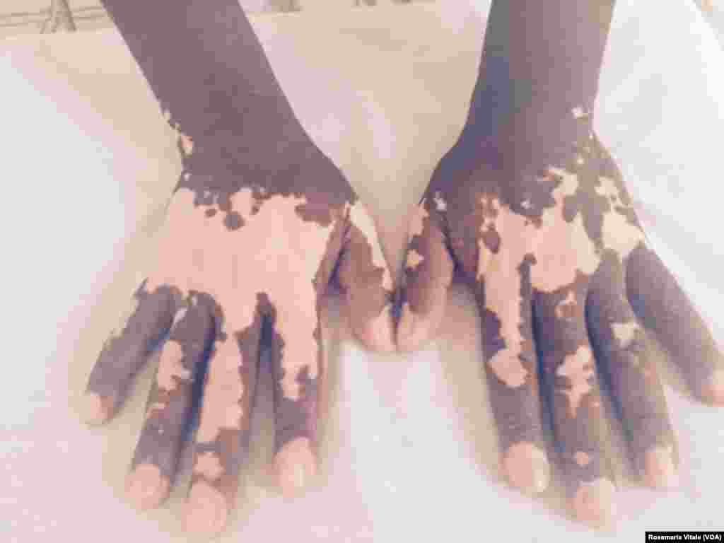 አብ ጉዕዞ ሊብያ-አውሮጳ ብነጋዶ ደቂ-ሰባት ኣእዳው ዝተቃጸለ ስእሊ እቲ ግዳይ አብ ኢጣልያ -ሚላን ስደተኛታት ካብ ዝሕክም ኢጣልያዊ ዝተረኽበ'ዩ