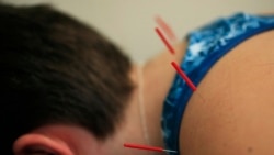 Quiz - US Health Agency Wants to Measure Pain